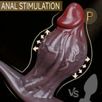 Remote Control Vibrating Butt Plug with Cock Ring, Silicone Prostate